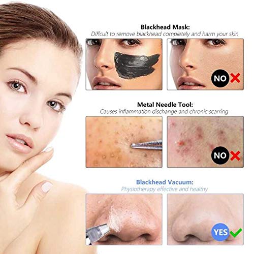 Blackhead Remover Vacuum Facial Acne Pore Cleaner Electronic Comedone Blackhead and Pore Removal Extraction Kit Rechargeable Acne Remover Tools for Women Men Face Nose